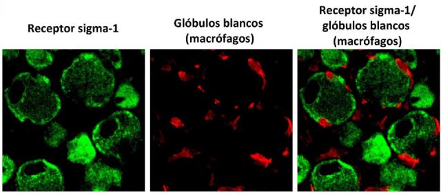 Marcaje inmunohistoquímico de las neuronas sensoriales periféricas que expresan el receptor sigma-1 (en verde), y marcaje de los glóbulos blancos (macrófagos, en rojo), tras la lesión de un nervio en el ratón Marcaje inmunohistoquímico de las neuronas sensoriales periféricas que expresan el receptor sigma-1 (en verde), y marcaje de los glóbulos blancos (macrófagos, en rojo), tras la lesión de un nervio en el ratón